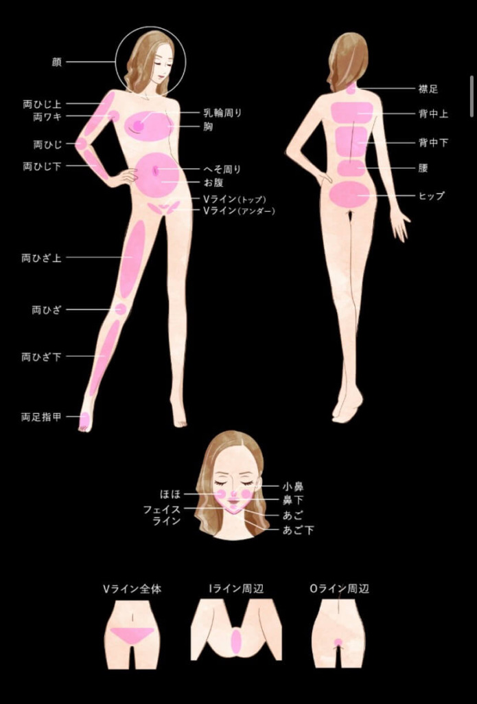 アイスレディー VIO