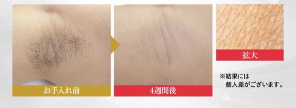 フォトEPC 効果